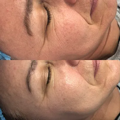 Dr.Olskin | Olena Khovzun | Medycyna Estetyczna | Kosmetologia | Medycyna ogólna